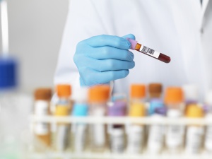 Close up of scientists hands selecting a blood sample for medical testing