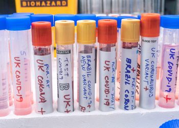 Covid-19 Varyantları ve Pandemi Süreci Konusunda En Çok Merak Edilen Güncel Sorular İçin Ekran Başına