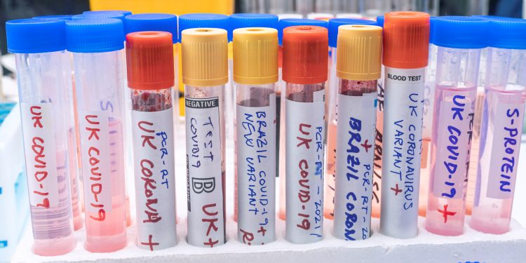 Covid-19 Varyantları ve Pandemi Süreci Konusunda En Çok Merak Edilen Güncel Sorular İçin Ekran Başına