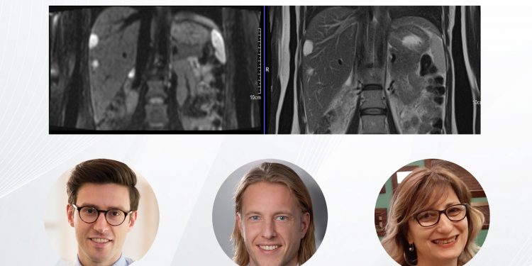 Siemens Healthineers Türkiye’nin Düzenlediği Webinar’a Katılmak için Hemen Kayıt Yaptırın