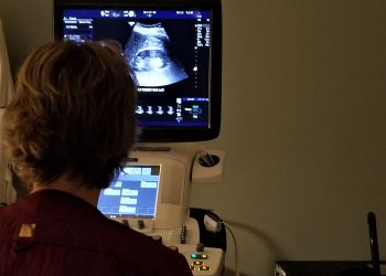 Böbrek Sağlığı İçin En Çok Merak Edilenler