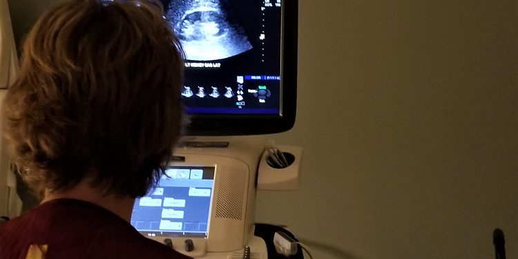 Böbrek Sağlığı İçin En Çok Merak Edilenler