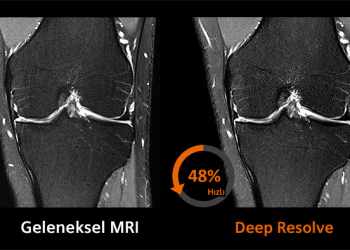 Siemens Healthineers tarafından düzenlenen “Deep Resolve ile MR görüntülemede verimliliğinizi artırın” konulu webinara davetlisiniz!