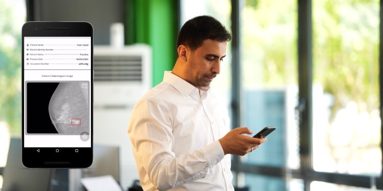 Yapay Zekâ ile Kanserde Erken Teşhis: MAMOSİS