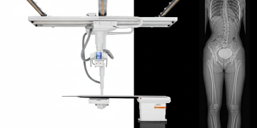 Klinik Karar Süreçlerini Güçlendiren Gerçek Ölçekli Görüntüleme